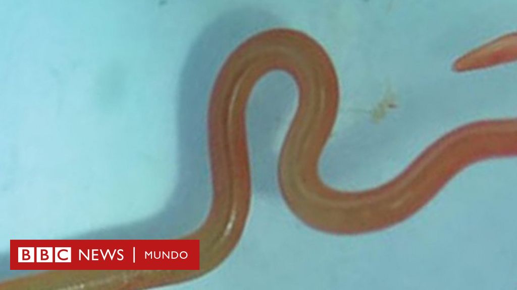 gusanos nematodos en humanos