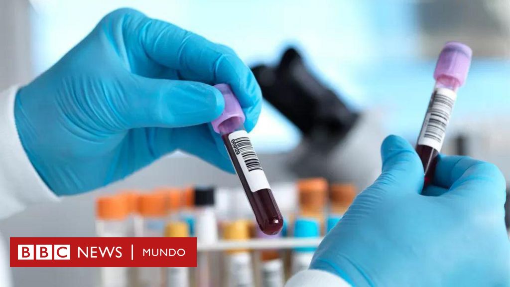 En Uruguay las pruebas médicas serán desde la próxima semana 