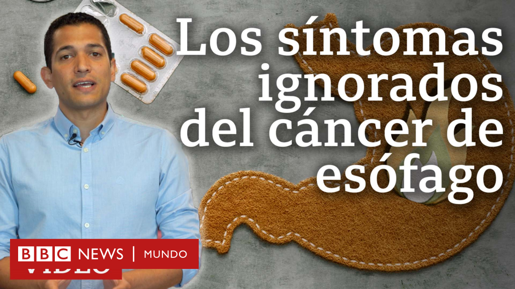 Cuáles Son Los Síntomas Del Cáncer De Esófago Y Por Qué No Debemos Ignorarlos Bbc News Mundo