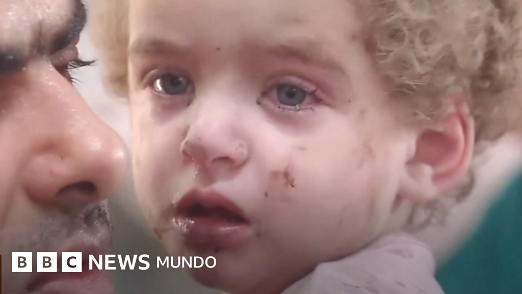Video: el hospital de Gaza desbordado con la llegada de niños heridos