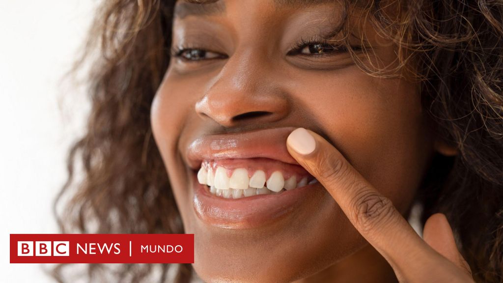 Qué puede provocar que tus encías se retraigan (y qué puedes hacer para evitarlo)