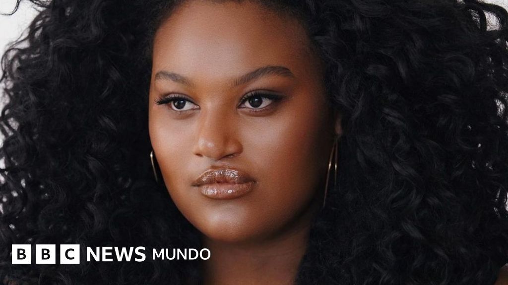 The woman with a cleft lip and palate who posed for Vogue and became a lipstick model - Archynewsy
