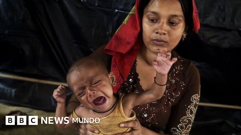 niños raquiticos en el mundo