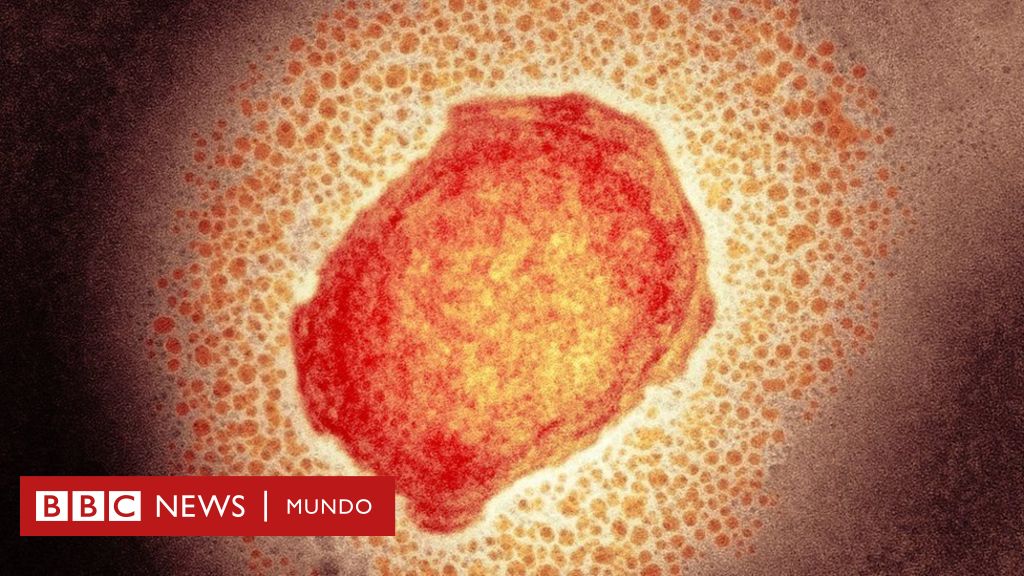 Qué es la "viruela de los monos", la rara infección que descubrieron en