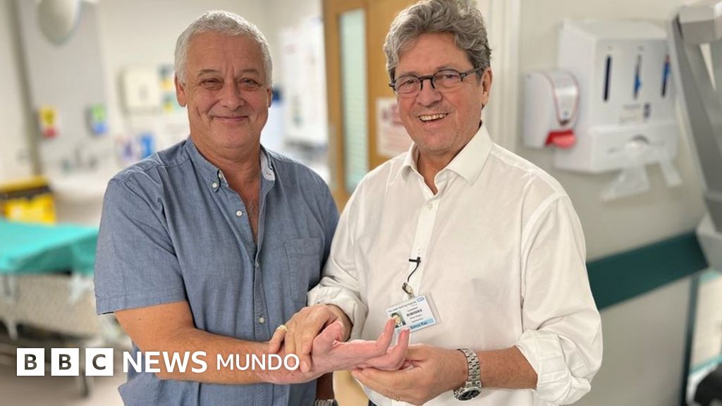 El singular reencuentro entre paciente y cirujano 10 años después del primer trasplante de mano en Reino Unido