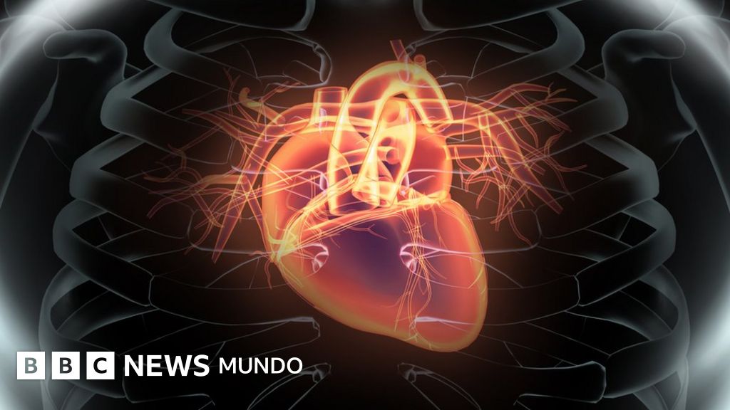 Puedes tener un ataque al corazón a los 20 Puedes tener un ataque al corazón a los 20