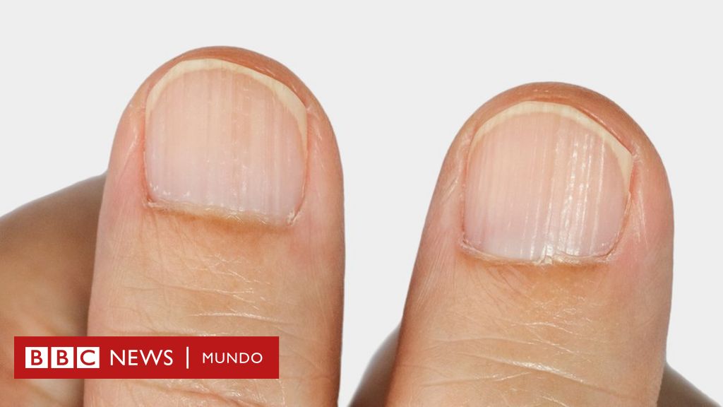 Frágiles, amarillentas o con blancas: cuáles son las anomalías y problemas frecuentes de las uñas - BBC News Mundo