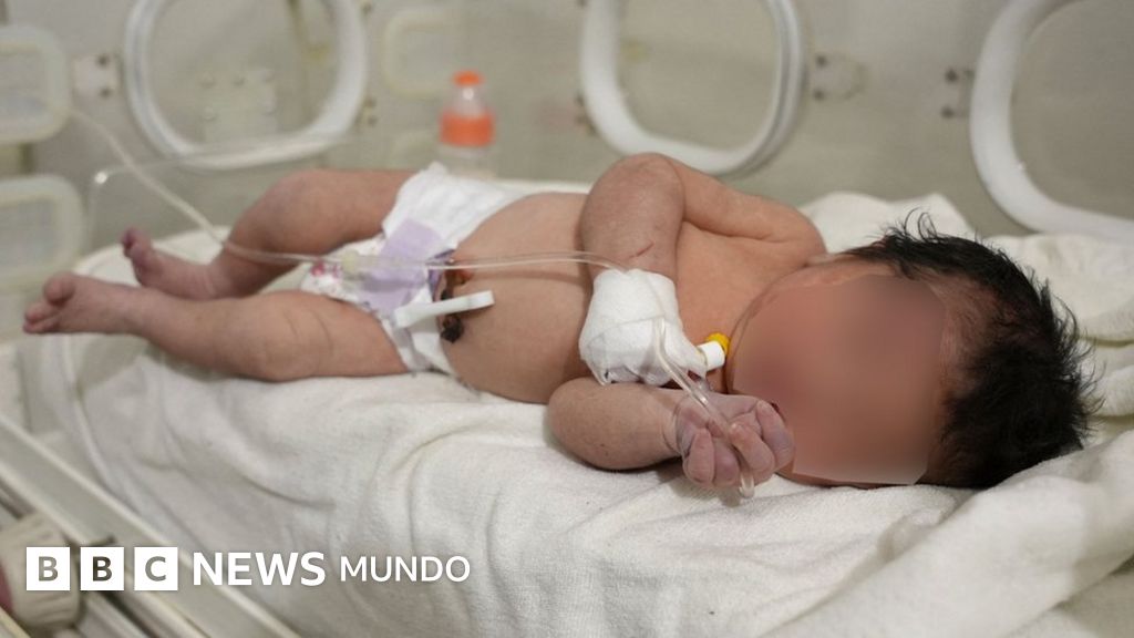 Terremoto en Turquía y Siria: la bebé recién nacida rescatada con vida y con el cordón umbilical intacto entre los escombros