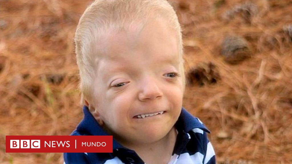 La Madre Que Lucha Contra Los Memes Que Se Burlan De Su Hijo De 3 Anos Gravemente Enfermo c News Mundo