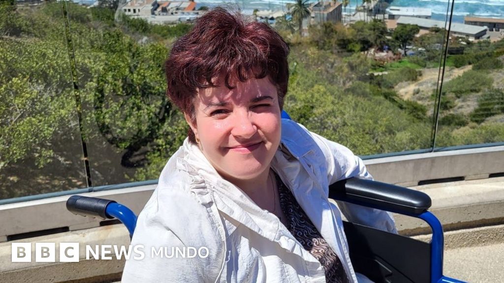 "En el salón de clases había una cama para mí": la ucraniana que creció en Cuba con la rara enfermedad de Larsen