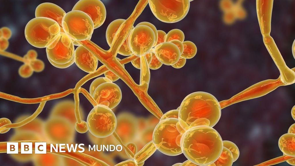 hongo candida como eliminarlo