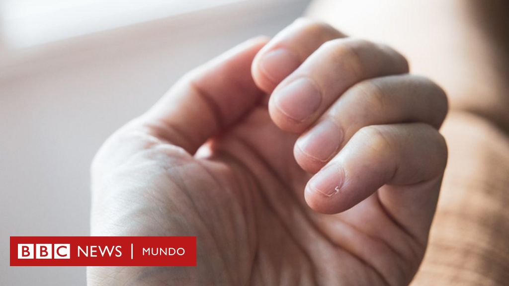 Cómo tus uñas te advierten sobre tu salud ayudan a enfermedades - BBC News Mundo