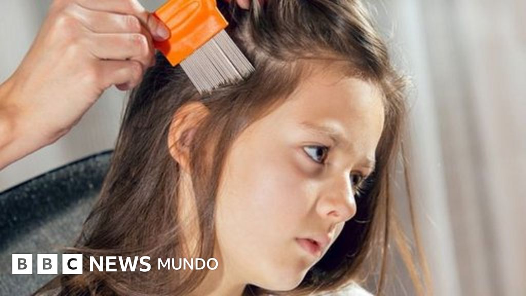 cómo eliminar los huevos de piojos muertos