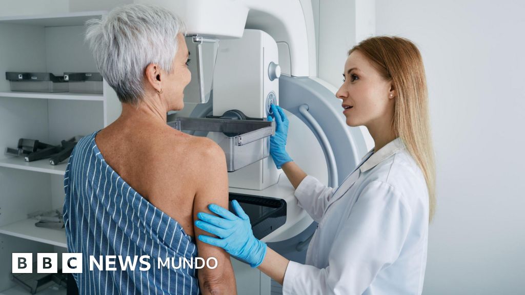 La píldora que ofrecerán a miles de mujeres en Reino Unido para prevenir el cáncer de mama