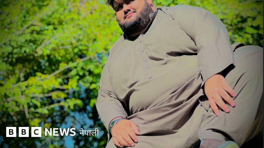 एक अफगान पुरुषले आफ्नो तौल २१६ केजीबाट घटाएर ९१ केजी कसरी बनाए?