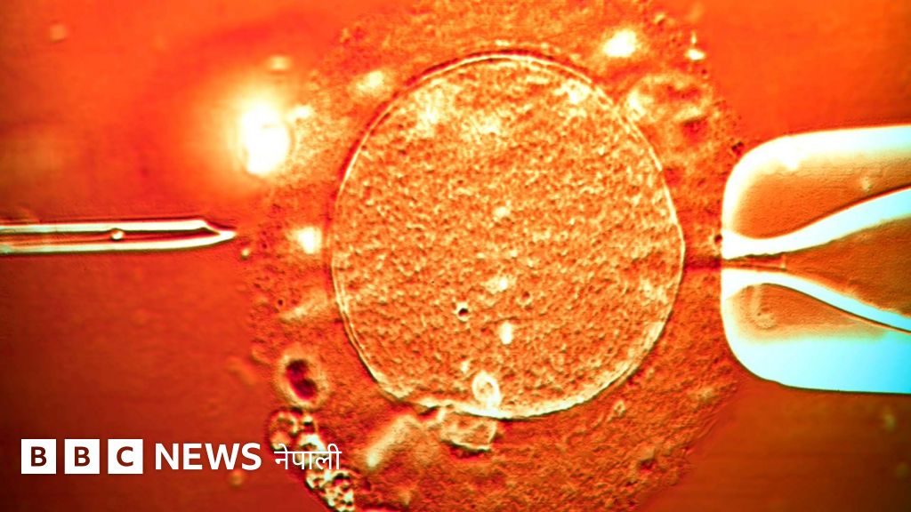 क्यान्सर गराउने वंशाणु भएको दाताको शुक्रकीट करिब २०० बच्चा जन्माउन प्रयोग