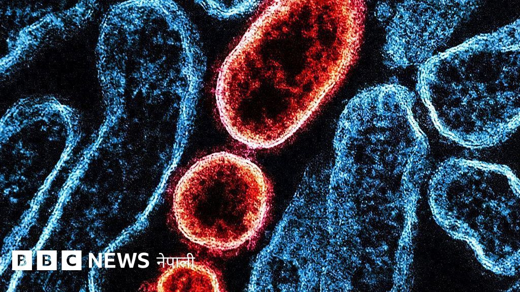 निपा भाइरस भित्रिन र फैलिन नदिने प्रयासमा नेपाल