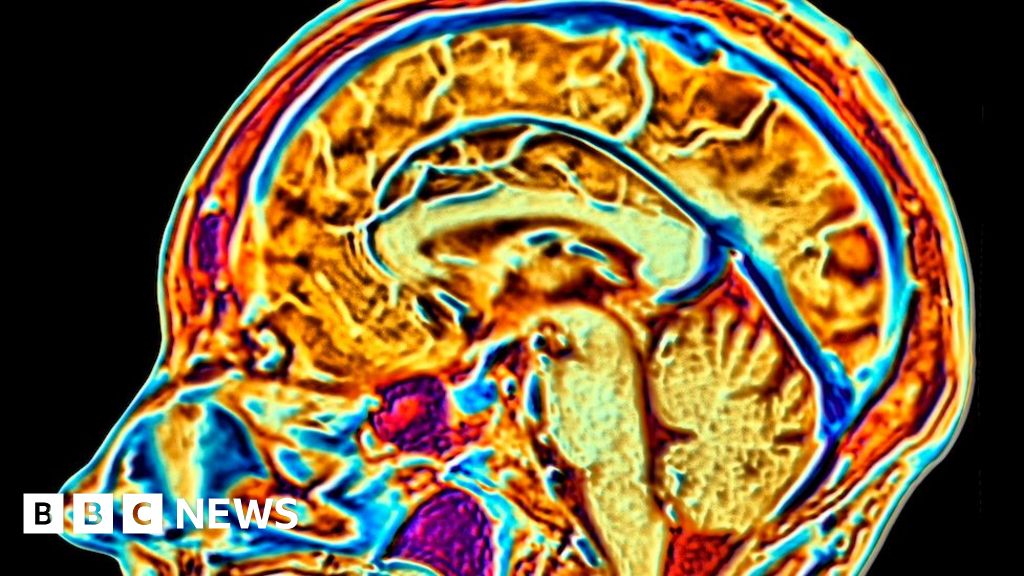 BBC News quiz of the week: What age did scientists say your brain reaches adulthood?