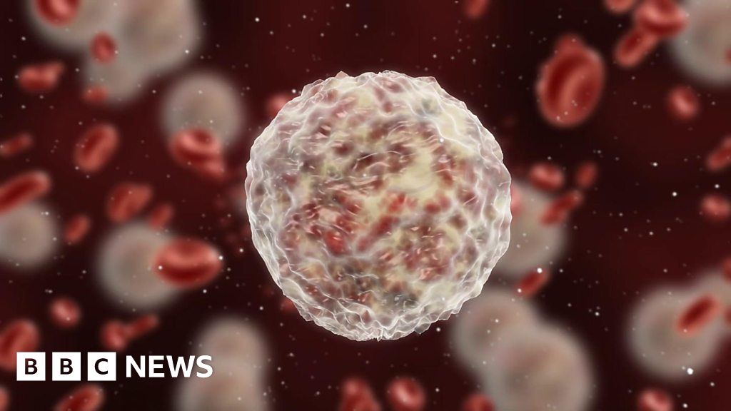 Could an overactive immune system cause depression? BBC News