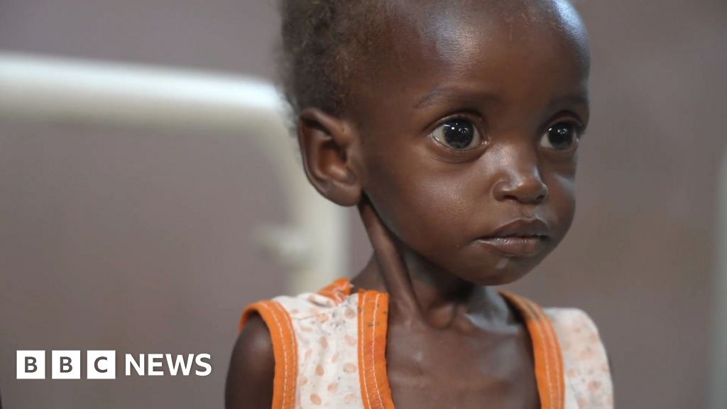 Inside a hospital on the front line of Sudan’s hunger crisis