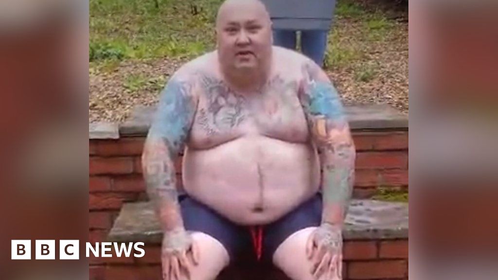 Nuneaton man loses 14 stone after refusing surgery