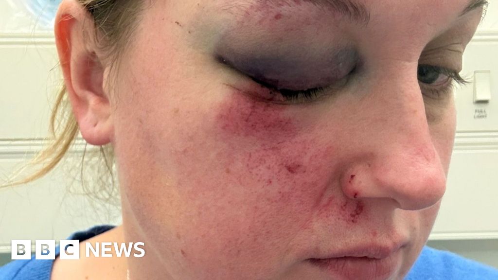Injuries, blown tyres and repair bills - frustration over 'spike' in potholes