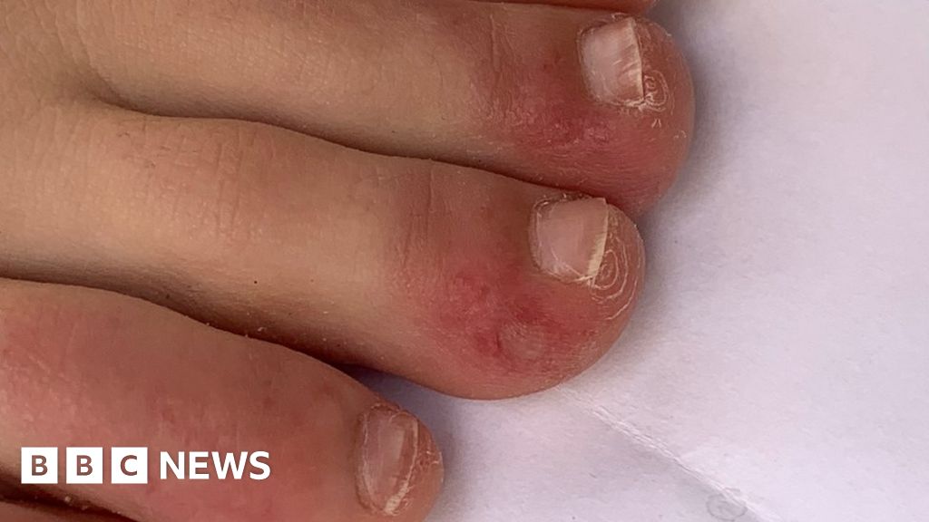 Small black dot on toenail
