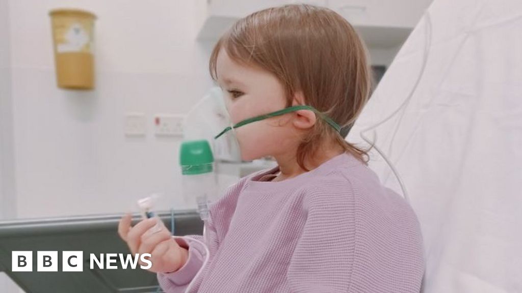 Starbucks Toddler with milk allergy has allergic reaction at Rugby