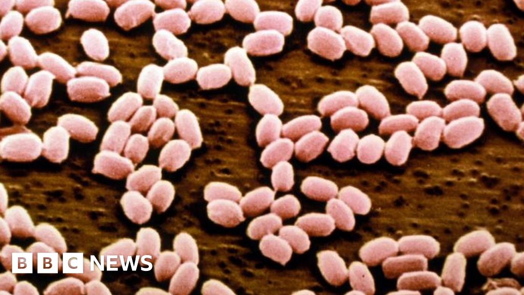 russia-anthrax-outbreak-affects-dozens-in-north-siberia-bbc-news