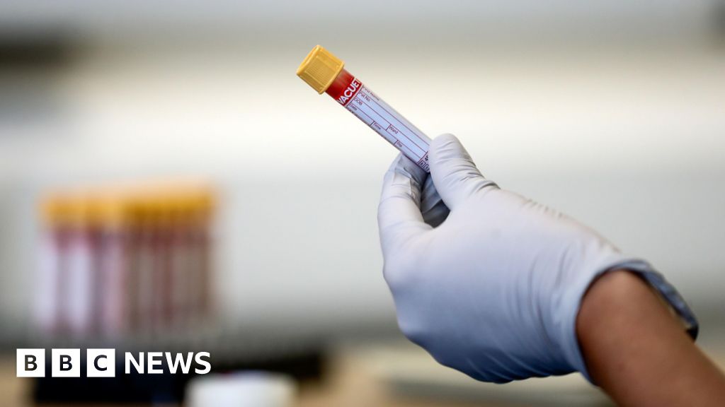 Blood test delays continue after cyber attack - GP