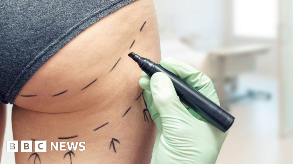 Brazilian butt lifts barred at Wolverhampton beauty clinic