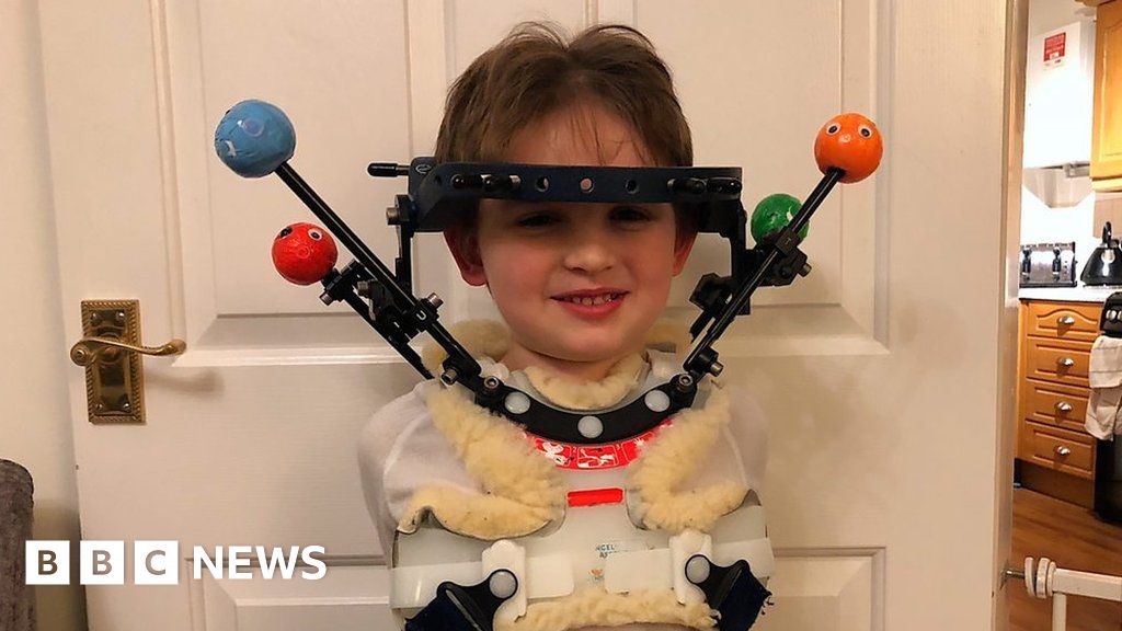 Halo brace boy from Long Stratton puts on brave face BBC News
