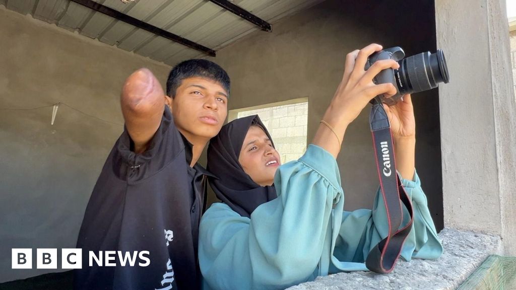 Easy-fit prosthetics offer hope to thousands of Gaza amputees