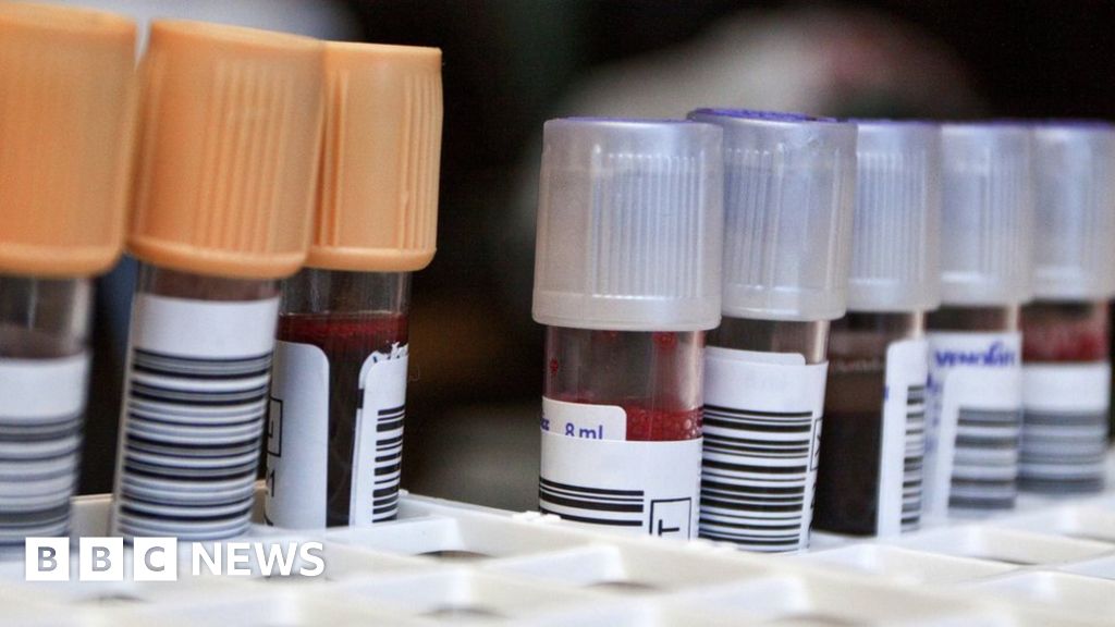 Is Blood Test For Prostate Cancer Accurate