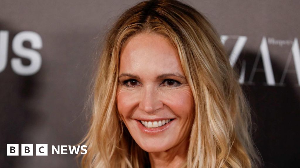 Elle McPherson: Supermodel reveals she had breast cancer