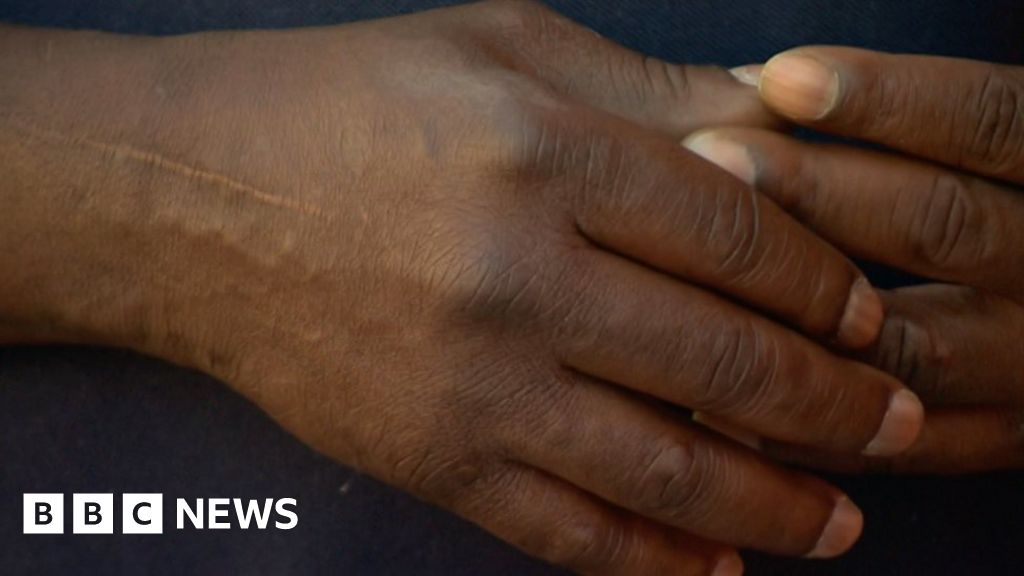 Asylum Seekers Hull Charity Says Hundreds Living Under The Radar