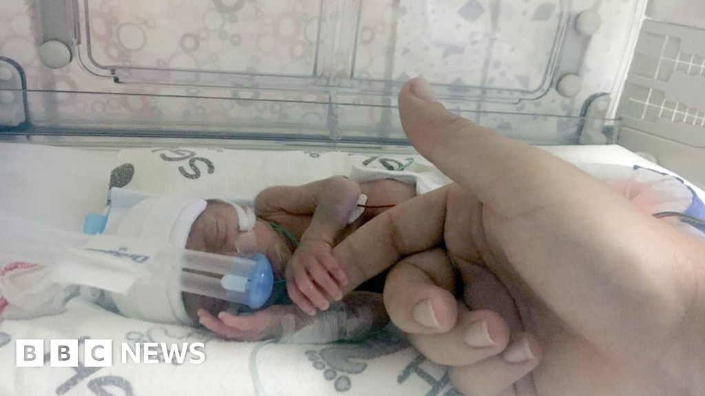 Lorcan remains in intensive care