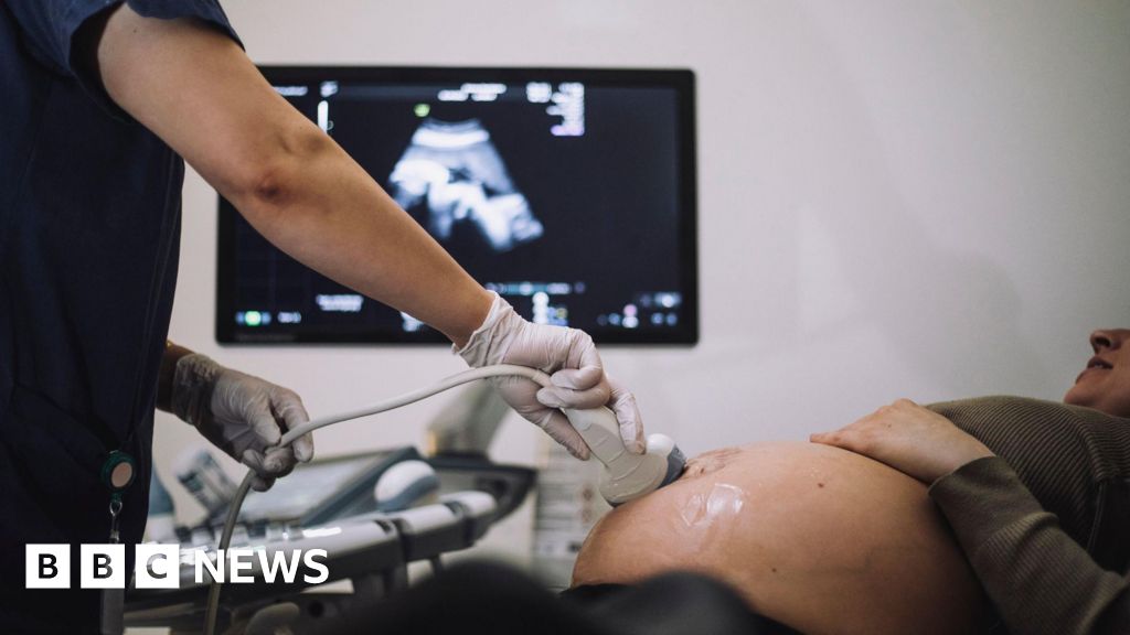 Private baby scan clinics putting expectant mothers at risk
