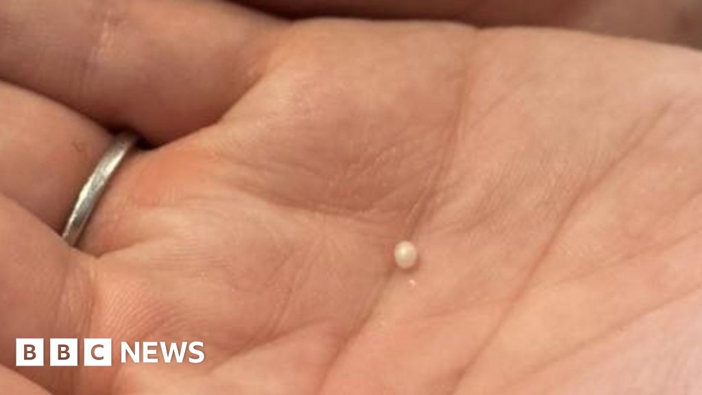 Woman's shock as pearl discovered at birthday meal