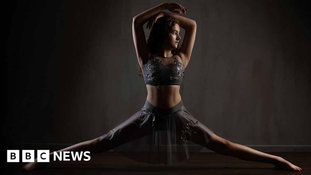 Teenage dancer from Leeds fundraising for spine surgery