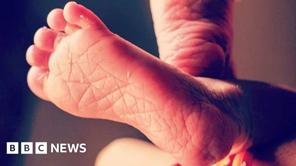 India police probe death of newborn 'mauled by dog' in hospital