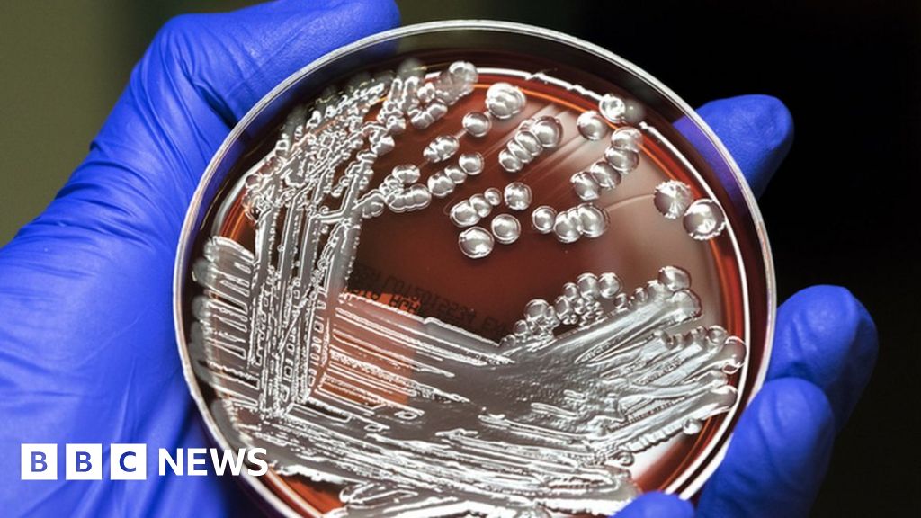 Superbug fight ‘needs farmers to reduce antibiotic use’
