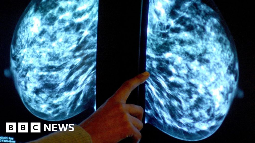 Breast cancer patients are at higher risk of secondary disease, study says