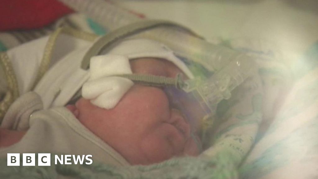 Premature Babies As Light As 1lb Surviving - BBC News