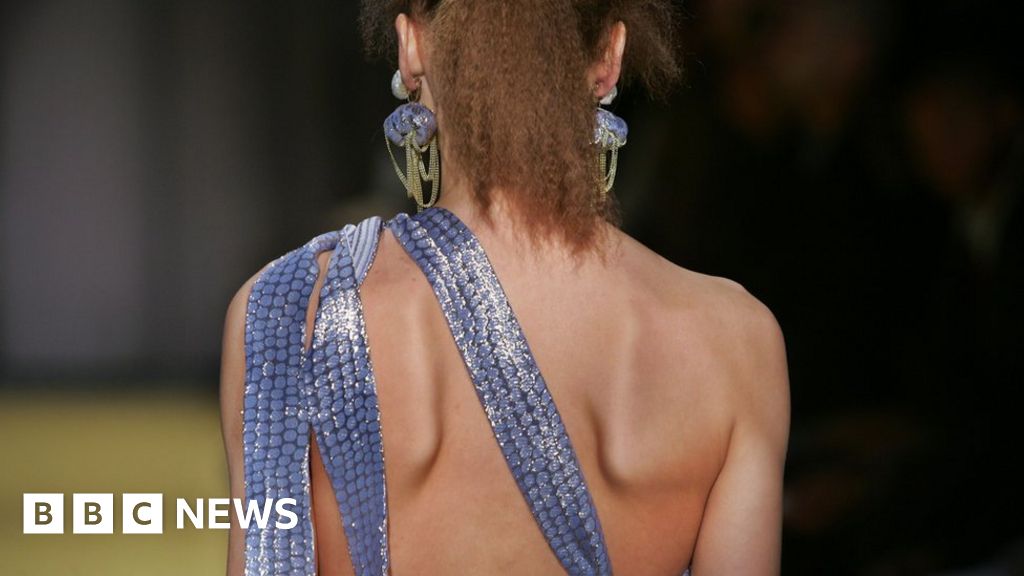 At a fashion show for people with SMA, models take back their own stories