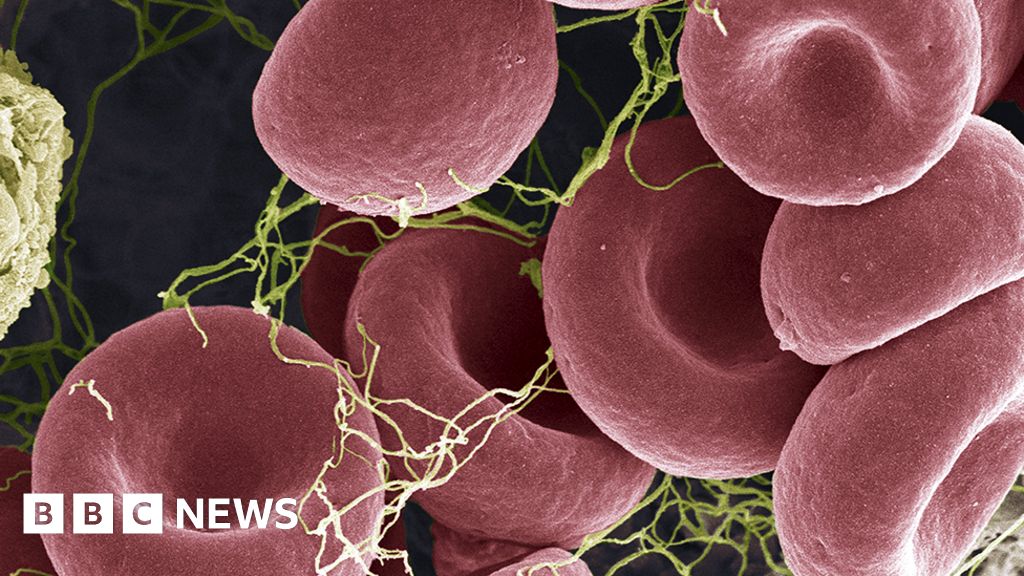 Rare blood clots - what you need to know