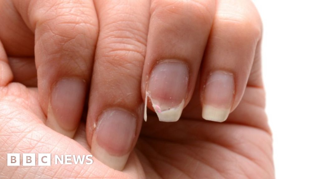 Why Are My Nails Peeling? - 9 Causes of Flaking, Peeling Nails