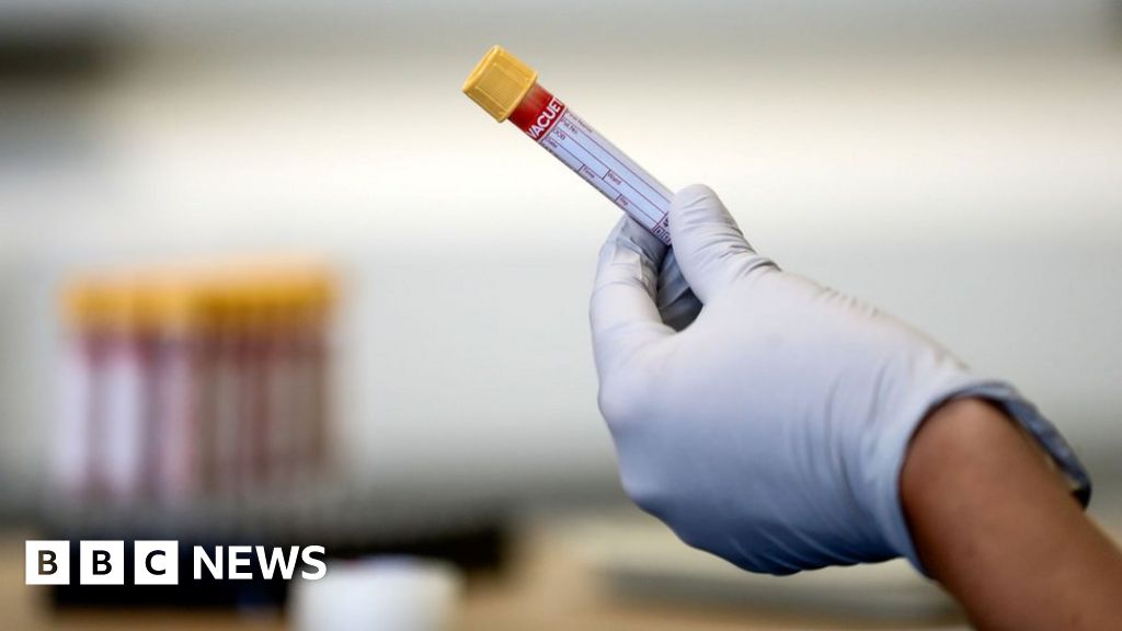 Coronavirus: Irish health officials' concern at localised spike - BBC News