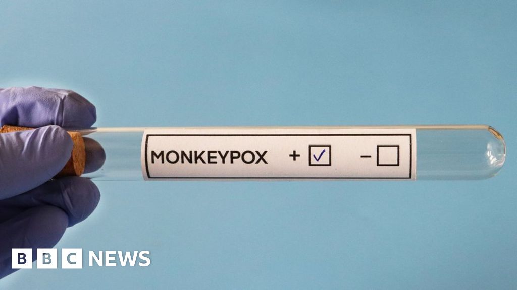 More than 300 monkeypox cases now found in UK