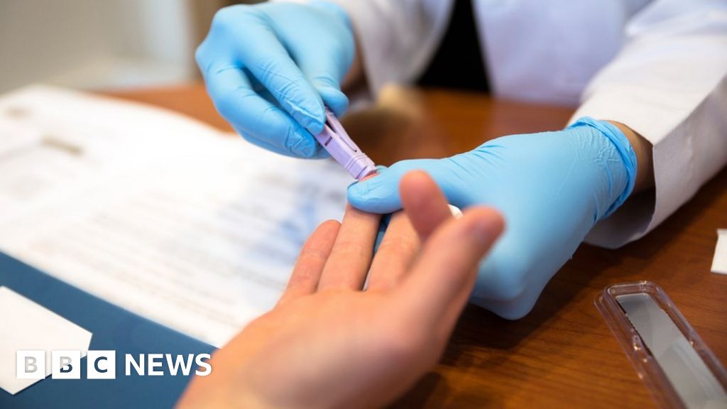 HIV tests for new GP patients 'can aid early diagnosis'